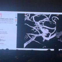 New Devices Can Cure Aneurysm In India - Says International Doctors At ANVI 3